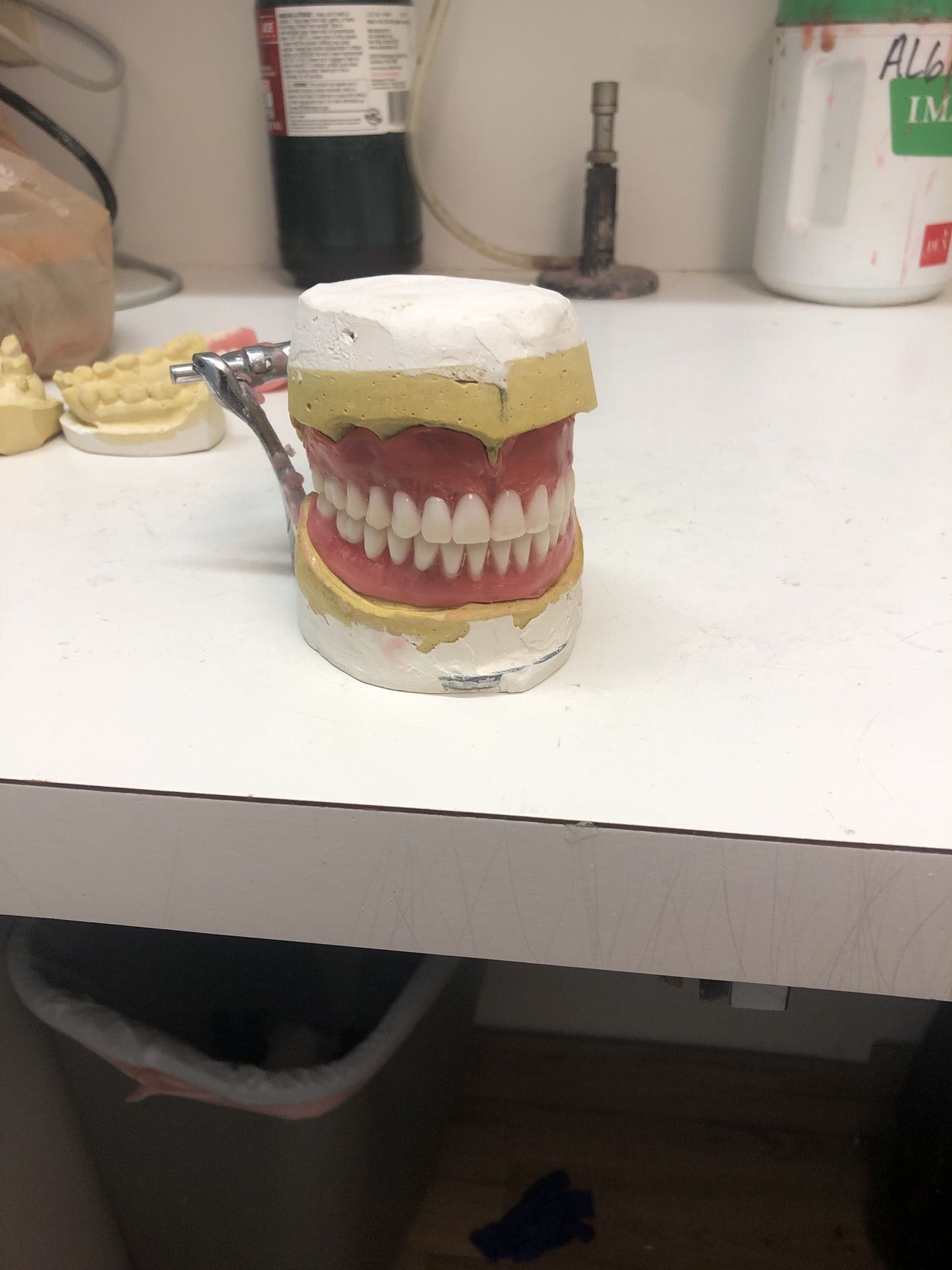 Emergency Denture Services gallery