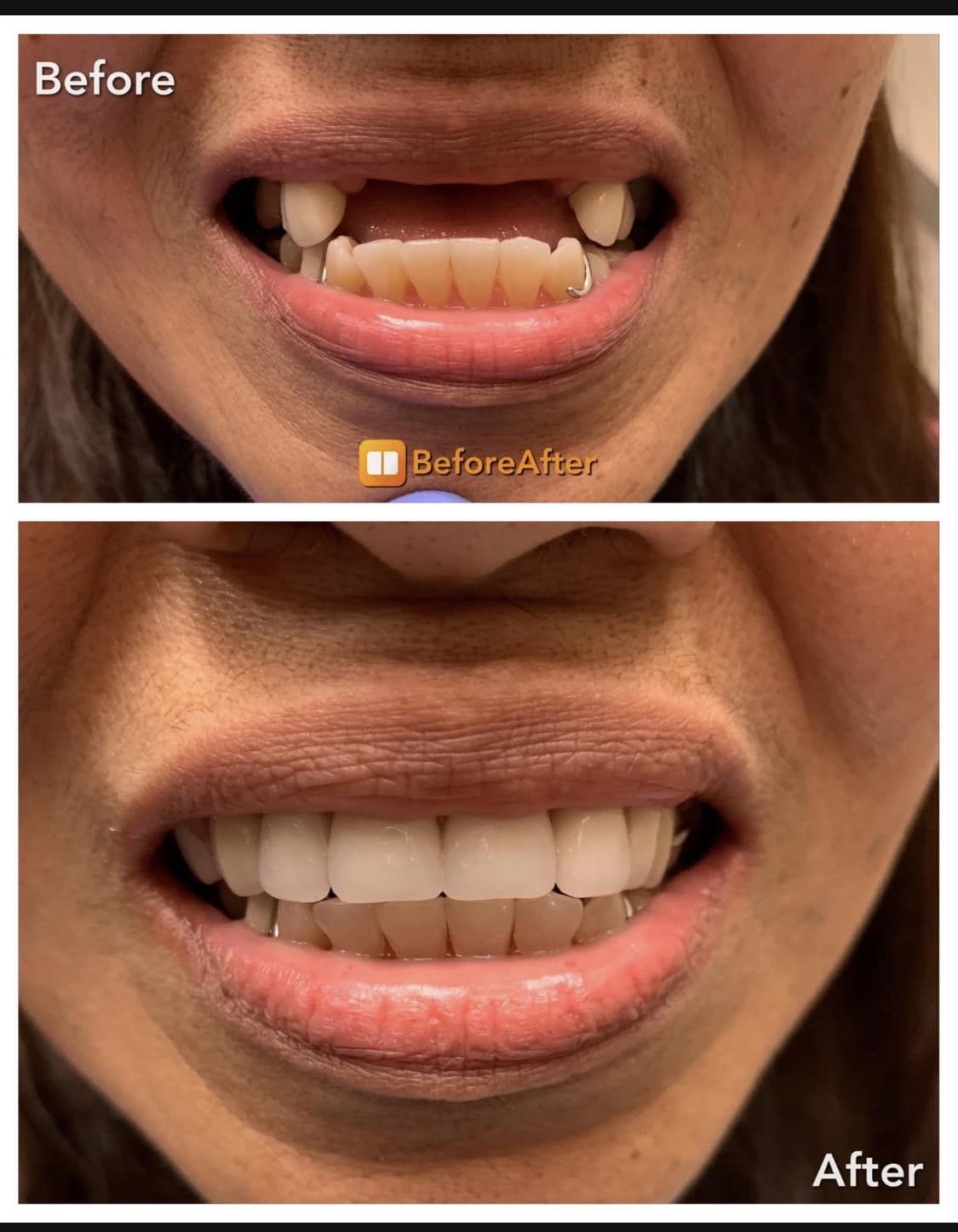 Emergency Denture Services gallery