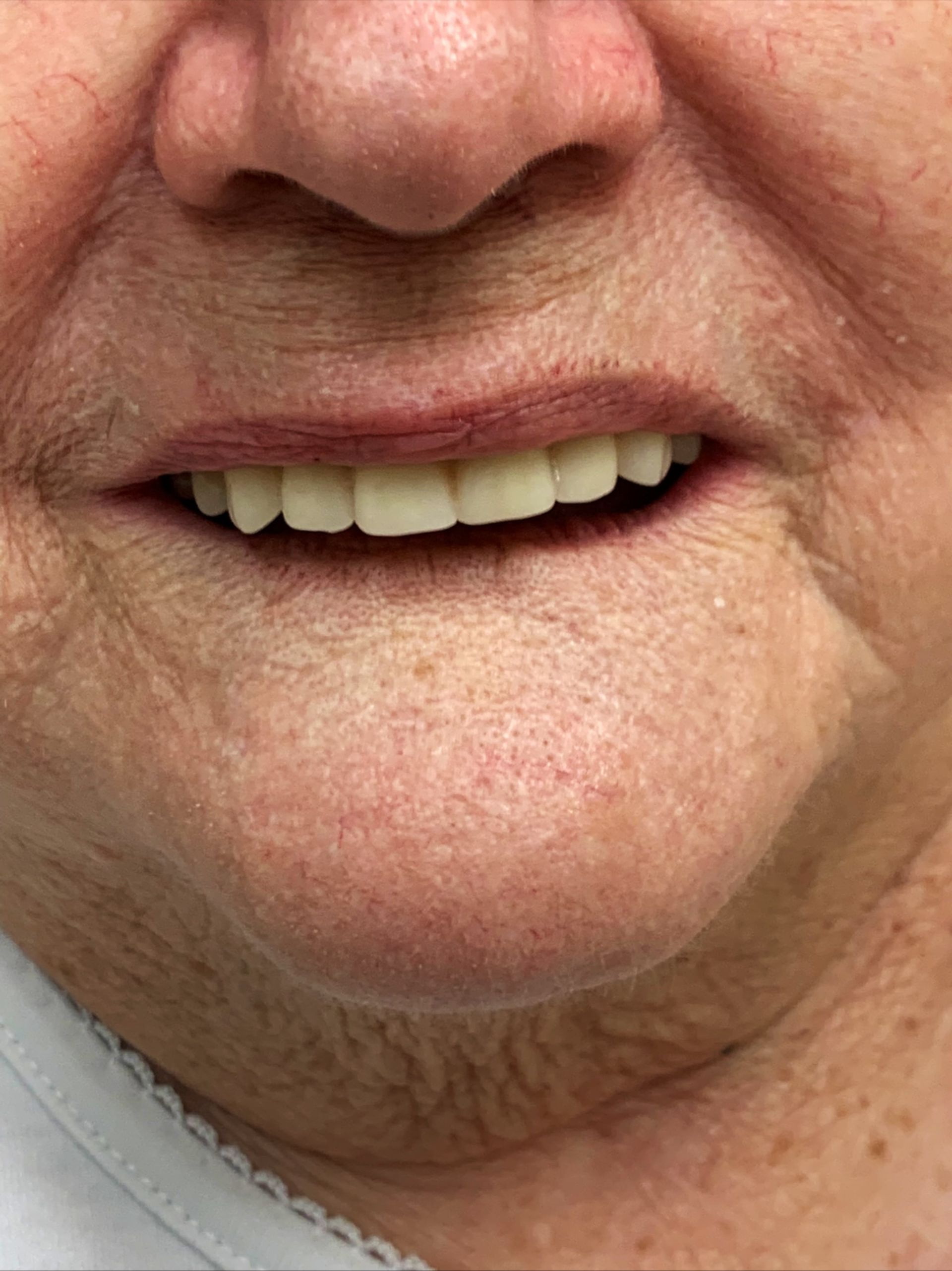 Emergency Denture Services gallery