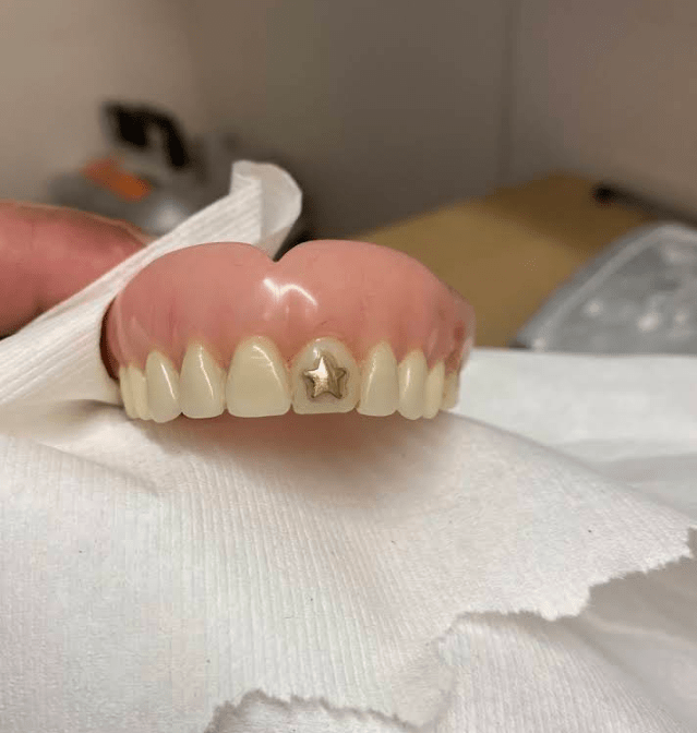 Emergency Denture Services gallery