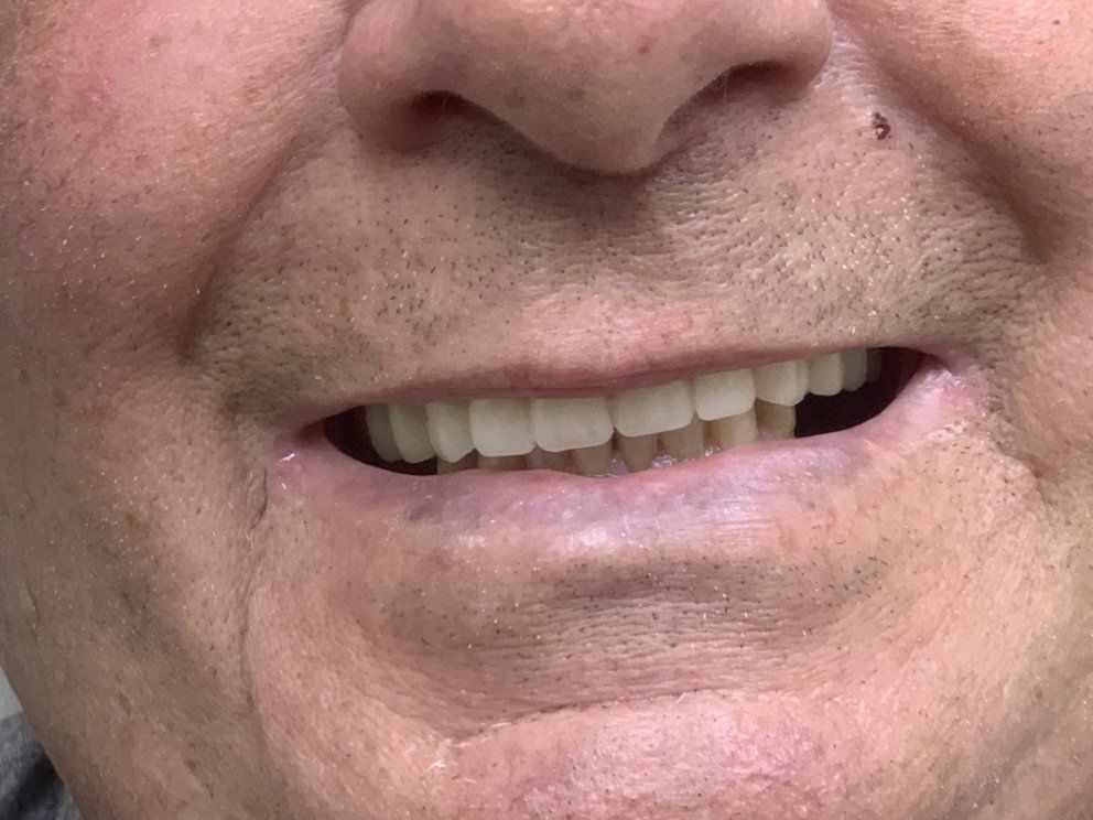 o